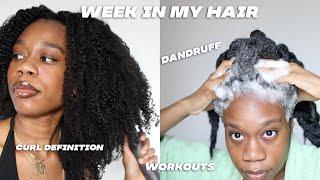 A REALISTIC WEEK IN MY NATURAL HAIR: WASH N GO EDITION! | GETTING RID OF DANDRUFF