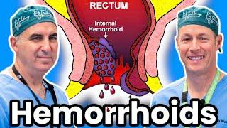 The Ultimate Treatment For Hemorrhoids