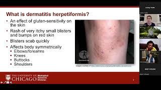 Dinner with the Doctor - Dermatitis Herpetiformis