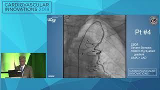 CVI2018 Session: Innovation in SVG interventions - Kendrick Shunk, MD