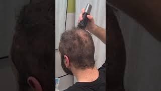 Curly Balding Hair Buzz Cut Transformation