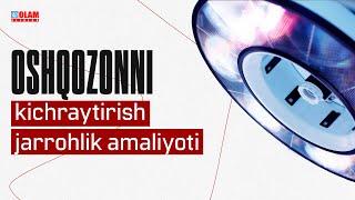 Oshqozonni kichraytirish jarrohlik amaliyoti | Olam Klinika