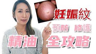 肚子有妊娠紋怎麼辦? 如何改善妊娠紋? 告訴妳精油健康保養攻略｜Essential oils for stretch marks｜Choco e芳療