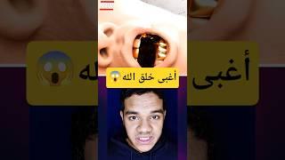 سرق طقم أسنان دهب من جثة واحد ميت
