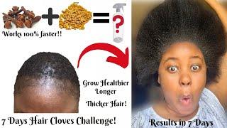 7 DAYS INTENSE CLOVES Challenge, Clove Water for Thicker hair Surprised  Shocking Results!!