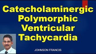 Catecholaminergic Polymorphic Ventricular Tachycardia