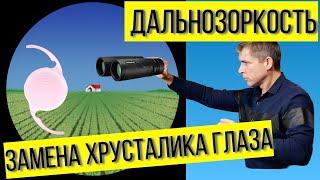 Замена хрусталика глаза при высокой дальнозоркости: какой хрусталик лучше