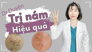 Điều trị nám đừng bỏ qua 4 Phương Pháp này | Dr Duyên