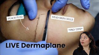 LIVE DERMAPLANE Q&A WITH MASTER AESTHETICIAN | #Skincare