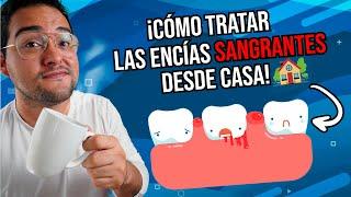 ¡CÓMO CURAR LAS ENCÍAS INFLAMADAS y SANGRANTES EN CASA! - ELIMINA LA GINGIVITIS 