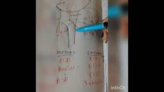 STROKES with mnemonics - made easy - NEUROLOGY