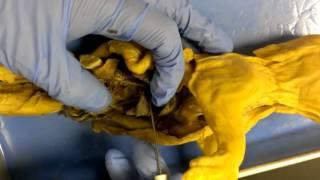4 Gaby&Oscar Day 4: Abdominal Cavity