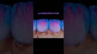 پودر گذاری لمینت