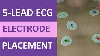 5 Lead ECG Placement of Electrodes (EKG) NCLEX & Nursing Mnemonic