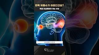 한쪽 뒷머리가 쿡쿡 찌르듯 아픈 이유? #두통 #목디스크 #거북목