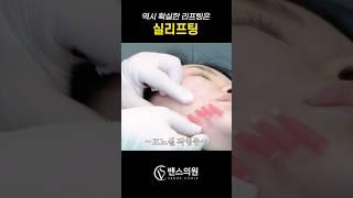 실리프팅 시술 영상 리얼한 전후!! #실리프팅 #리프팅 #리프팅효과