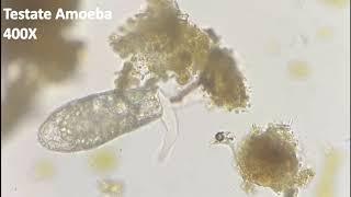 MY JOURNEY to the MICROCOSMOS - Ep.4