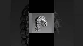 Dental Health Care | Dr. Wasif Rashid | Dentist | #foryou #shorts
