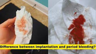 implantation bleeding vs period|implantation bleeding or period|implantation vs period