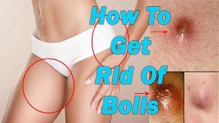 How To Get Rid Of Boils On Inner Thighs And Buttocks