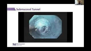 Third Space Intraluminal Endoscopy Webinar