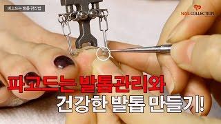 파고드는 발톱과 손상된 발톱을 관리하는 올바른 방법! 더이상 고통은 참자마세요! _Nailcollection by midae