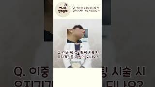 #숏츠 #Shorts 언니의 시술 리뷰 보기 - 이중턱 실리프팅의 유지기간은?