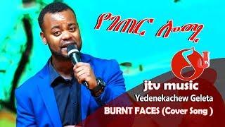 Jtv Music Yedenekachew Geleta ''የገጠር ሎሚ'' - BURNT FACES  (Cover Song )