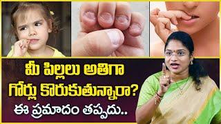 Asleshah : Nail Biting, Causes, Signs and Symptoms | How to Stop Biting Your Nails | Mr Nag