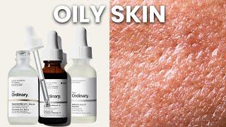 Top 5 Ordinary Skincare for Oily Skin + How To Layer Them