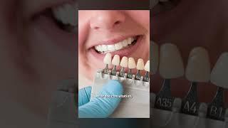 Teeth Whitening I Steps