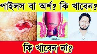 পাইলস হলে কি খাবেন?পাইলস হলে কি খাবেন না?অর্শরোগে কি খাবেন?গেজ হলে কি খাবেন?How to relieve piles?