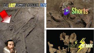 Evidence of 31 THOUSAND YEAR OLD AMPUTATION!! Discovered in Borneo #shorts