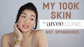 MY 12OK PESO SKIN TREATMENTS AT THE AIVEE CLINIC AND WHY IT WAS SUCH A FAIL| COSMELAN| Charlotte F