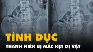 Thanh niên đi cấp cứu vì bị kẹt đồ chơi tình dục