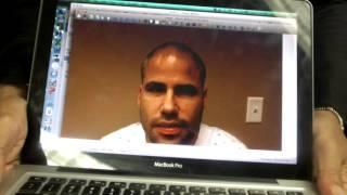 2500 g ARTAS & Manual (Hybrid) Hair Transplant, by Dr William Yates