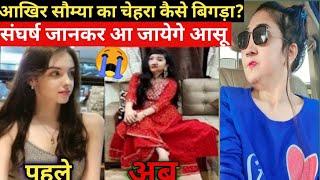 आखिर Sommya Jain का चेहरा कैसे बिगड़ा / Sommya Jain Biography /Sommya Jain Lifestyle /Somya Jain