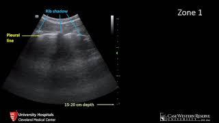 How to Lung Ultrasound