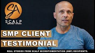 Scalp Micropigmentation Experience at Scalp Amplified Studios, Oakville, ON - Silvio's review