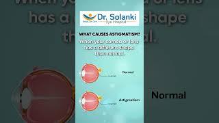 UNDERSTAND ABOUT ASTIGMATISM | DRSOLANKI EYE HOSPITAL | #shorts