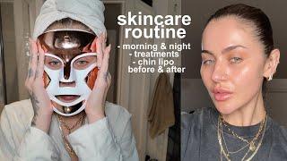 SKINCARE ROUTINE & WHAT I'VE DONE: chin lipo & treatments | JAMIE GENEVIEVE