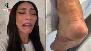 "It's Karma" Tommie Lee Responds To Trolls Criticizing Her Leg Injury Suffered In Jamaca! 