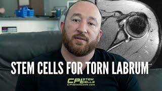 Stem Cells for Torn Labrum - He Can Finally Sleep Without Pain