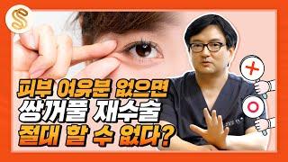 피부 여유가 없는 눈은 쌍꺼풀 재수술 못한다?