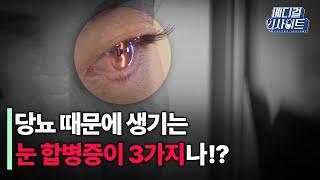 당뇨환자가 조심해야 할 눈 합병증은?ㅣ메디컬 인사이트[62회] / YTN2