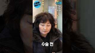 60대 여자 안면거상 #facelift