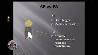 Understanding Radiology Terminology  - Chest X-Rays Part 2 of 4