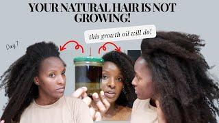 Use This Growth Oil and Your Hair Will Never Stop Growing| DIY 1MONTH OLD for HAIR LOSS & THINNESS