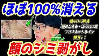 【整形級に顔のシミが消えて53歳⇨43歳】視聴者さんの顔のシミが消えた！ほうれい線・マリオネットライン・ゴルゴライン・顔のたるみも解消するエクササイズ！首コリ・肩こり・頭痛まで解消！