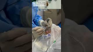 Advanced Suture-less Micro Incision retinal surgeries available at Eye Care Hyderabad